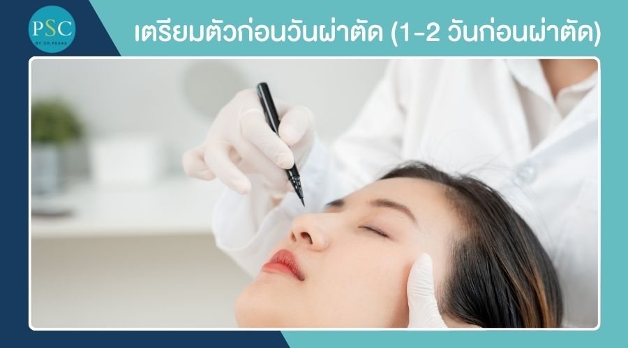 เตรียมตัวก่อนวันผ่าตัด (1-2 วันก่อนผ่าตัด)