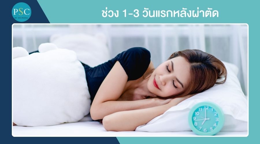 ช่วง 1-3 วันแรกหลังผ่าตัด