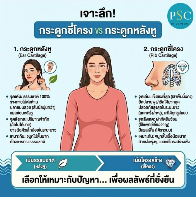 เจาะลึก! กระดูกซี่โครง vs กระดูกหลังหู ใช้อะไร "รองปลายจมูก" ปลอดภัยที่สุดในระยะยาว?