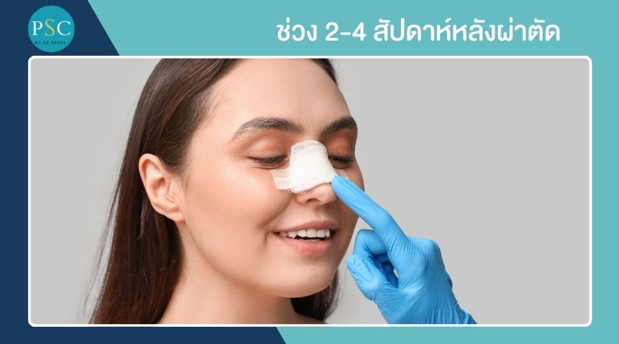 ช่วง 2-4 สัปดาห์หลังผ่าตัด