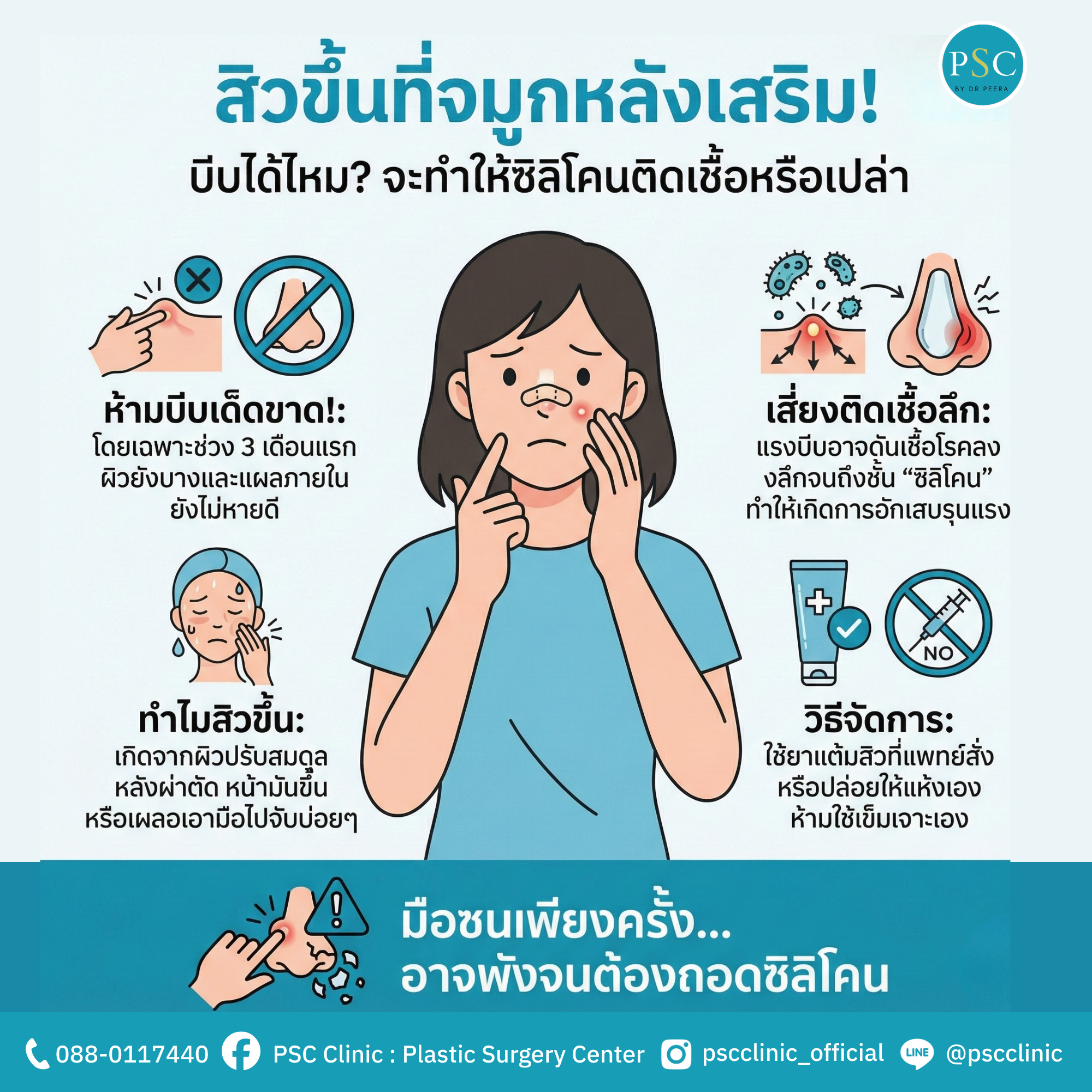สิวขึ้นที่จมูกหลังเสริม! บีบได้ไหม? จะทำให้ซิลิโคนติดเชื้อหรือเปล่า