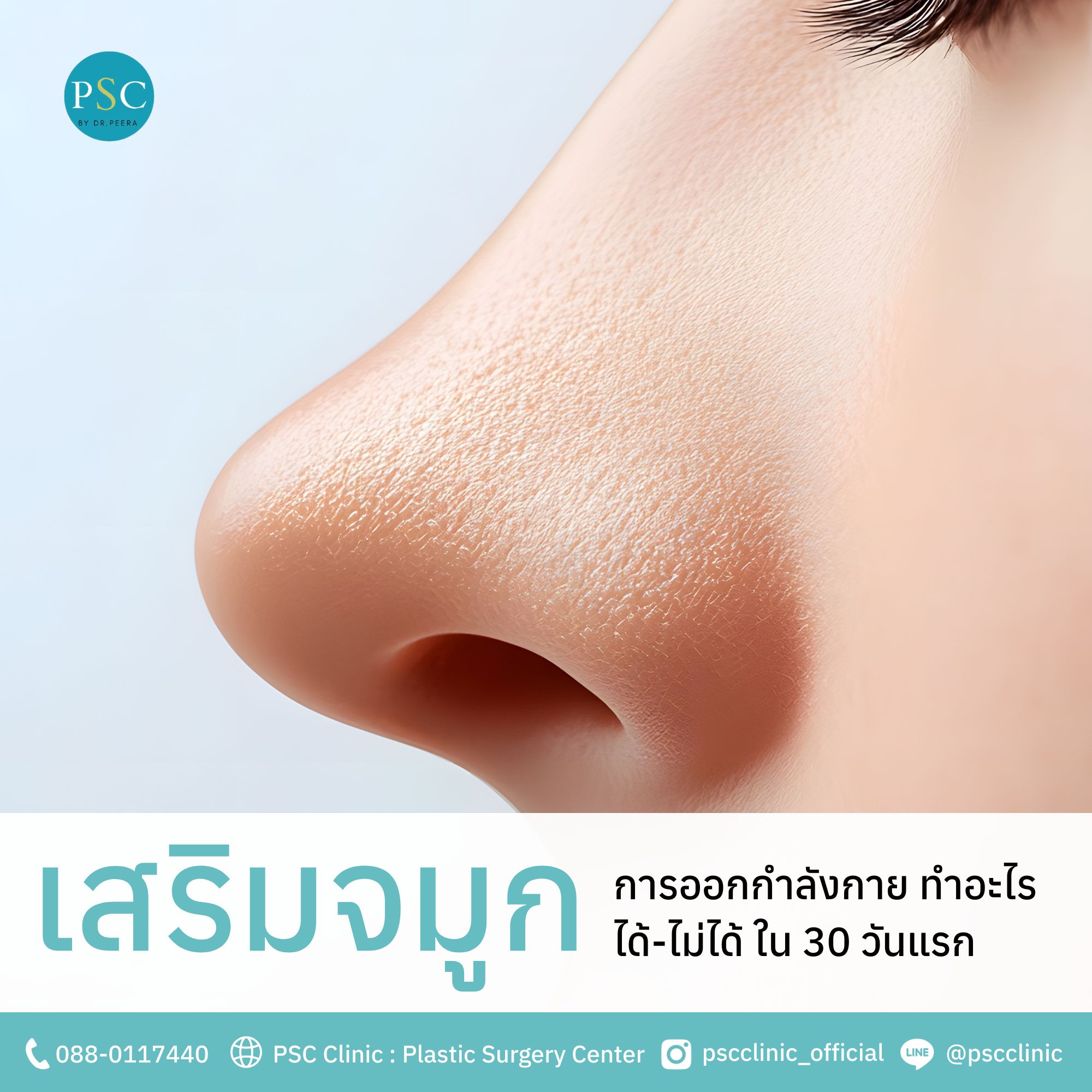 เสริมจมูกกับการออกกำลังกาย ทำอะไรได้-ไม่ได้ ใน 30 วันแรก