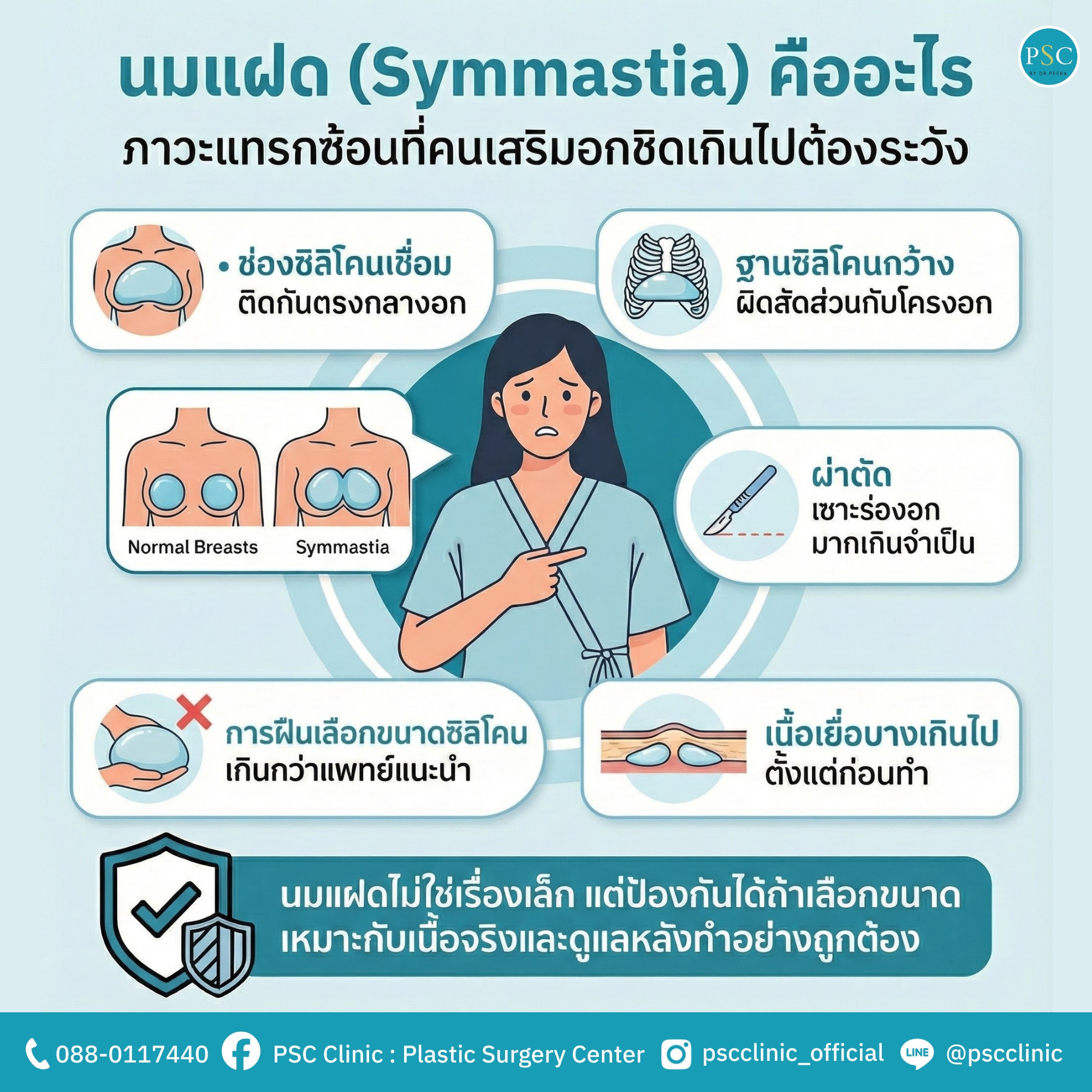 นมแฝด (Symmastia) คืออะไร ภาวะแทรกซ้อนที่คนเสริมอกชิดเกินไปต้องระวัง
