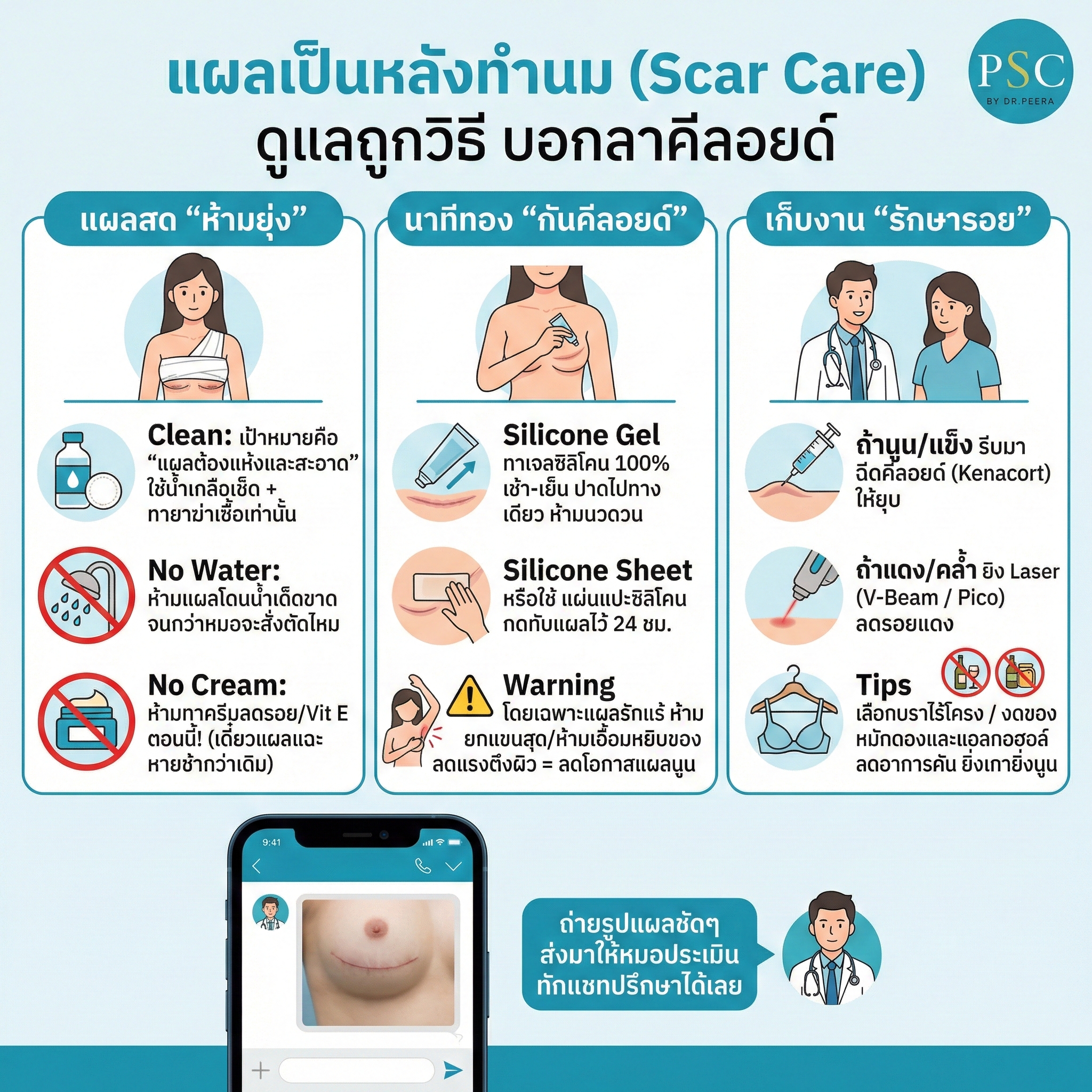 แผลเป็นหลังทำนม (Scar Care) รวมวิธีดูแลแผลไม่ให้เป็นคีลอยด์ ตั้งแต่เริ่มทายาจนถึงเลเซอร์