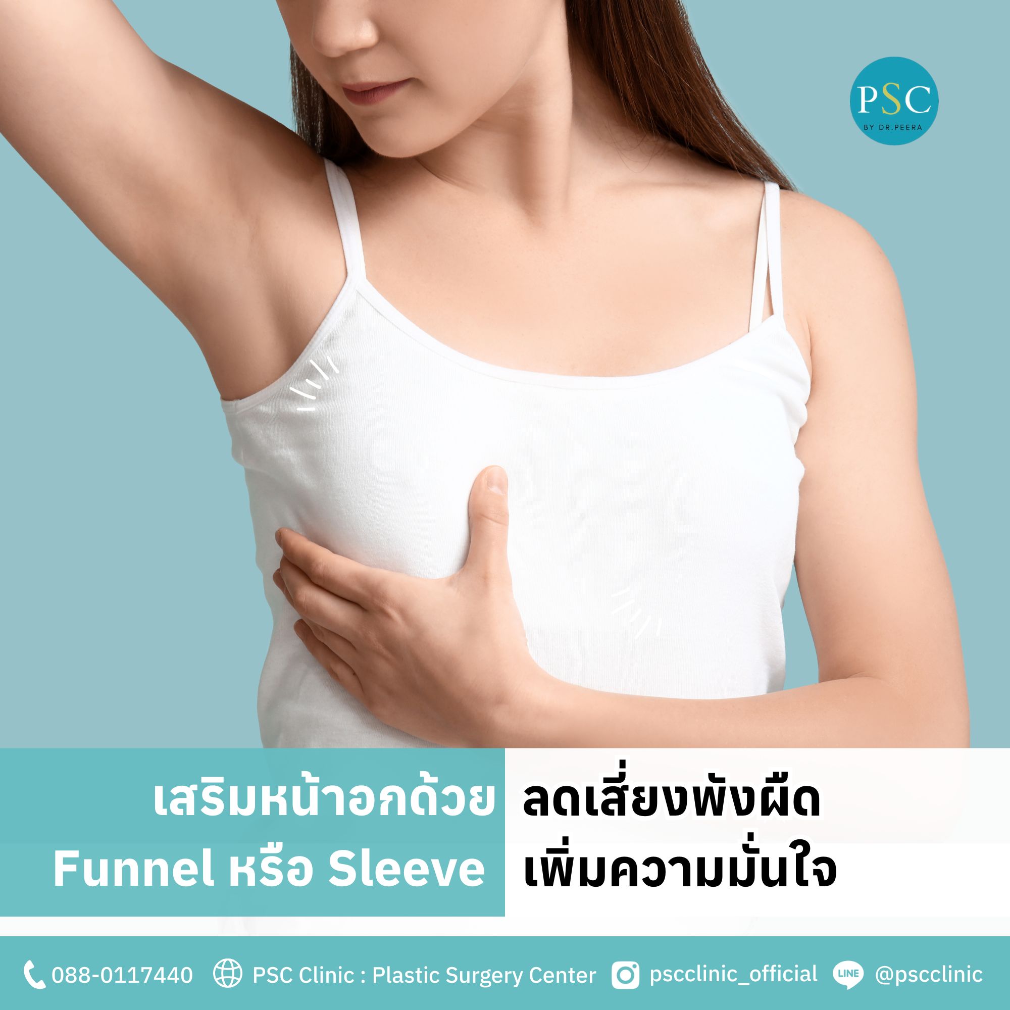 เสริมหน้าอกด้วย Funnel หรือ Sleeve ลดเสี่ยงพังผืด เพิ่มความมั่นใจ