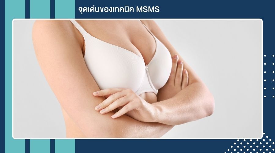 จุดเด่นของเทคนิค MSMS