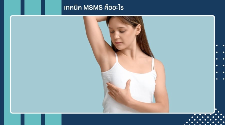 เทคนิค MSMS คืออะไร