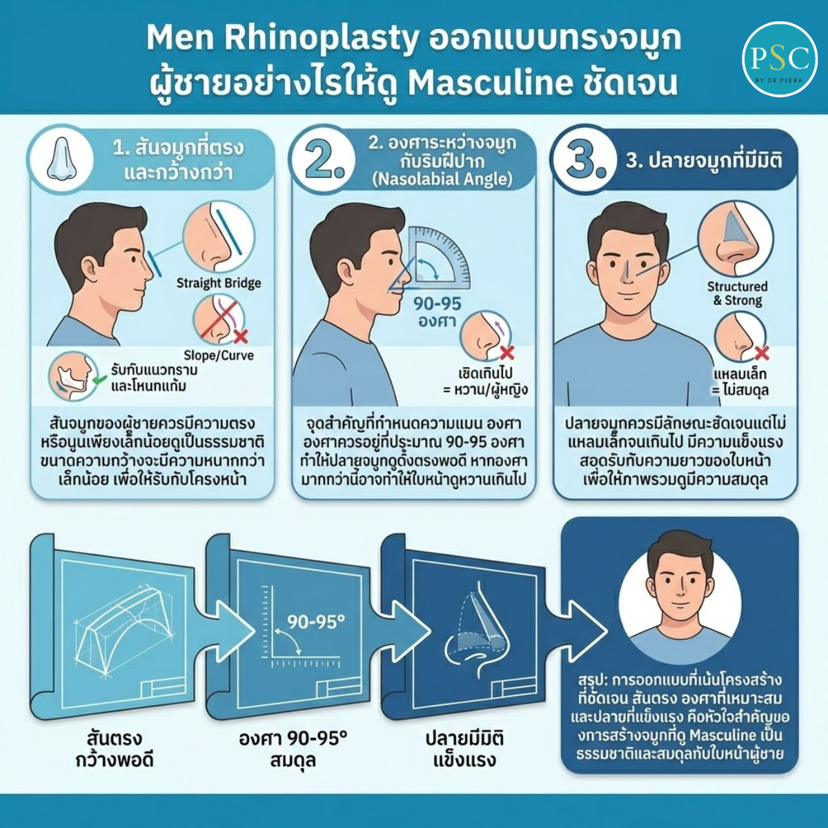 Men Rhinoplasty ออกแบบทรงจมูกผู้ชายอย่างไรให้ดู Masculine ชัดเจน