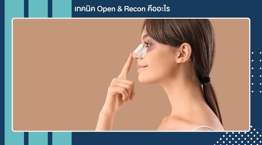 เทคนิค Open & Recon คืออะไร (1)
