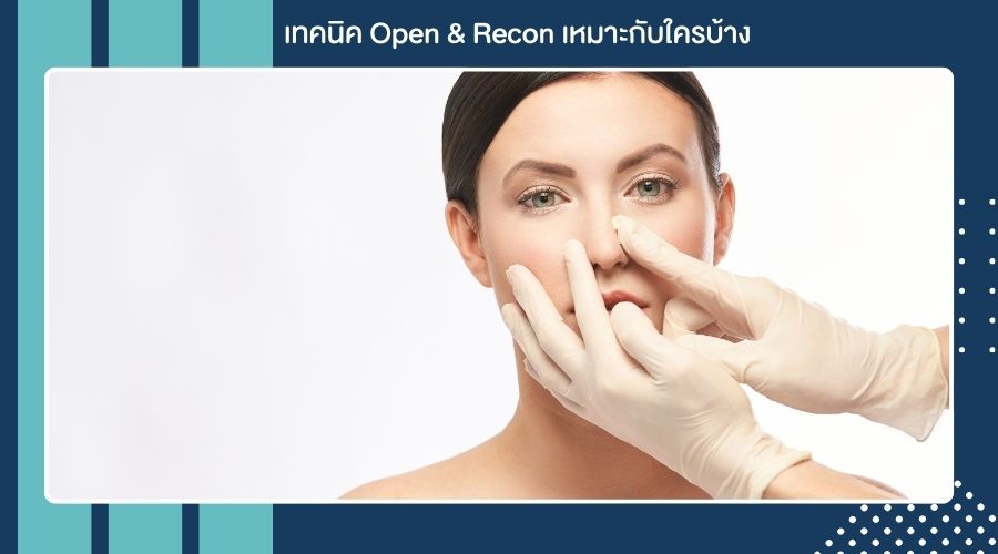 เทคนิค Open & Recon เหมาะกับใครบ้าง