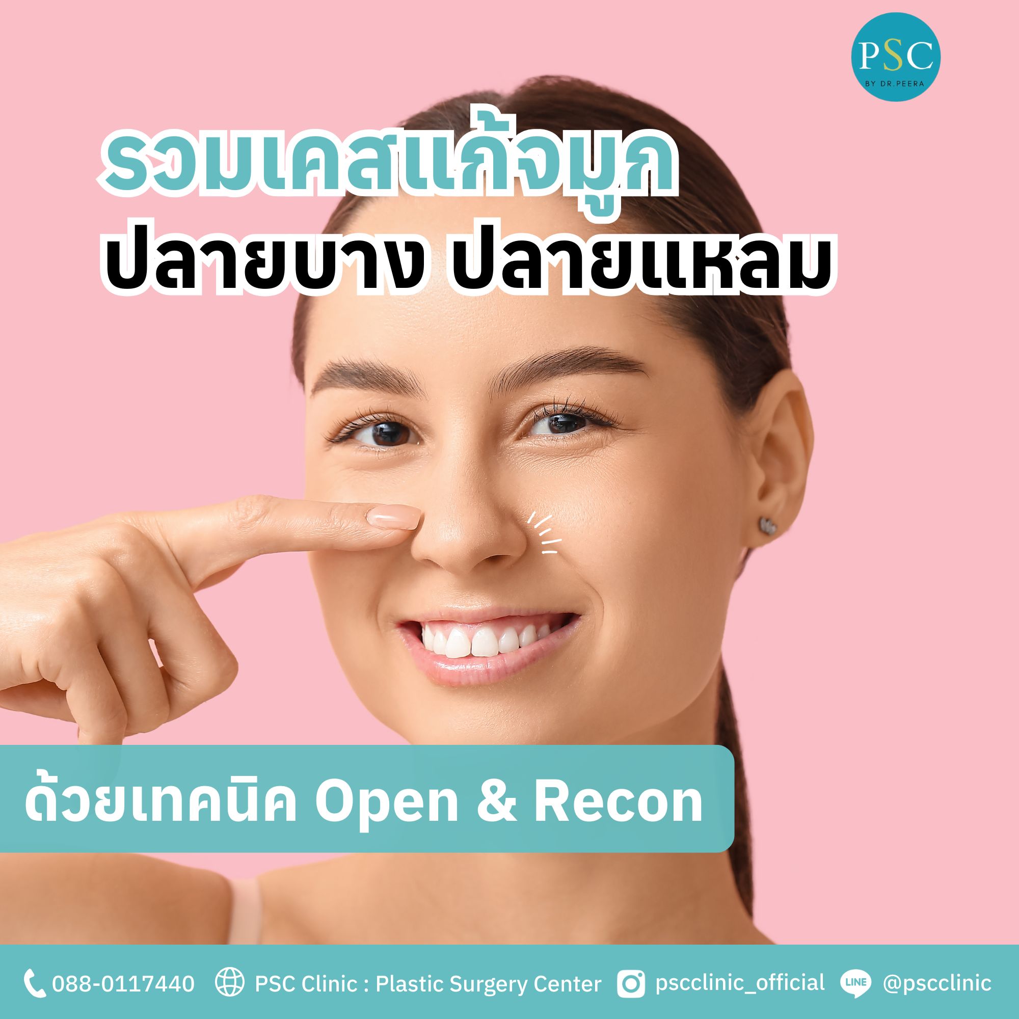รวมเคสแก้จมูกปลายบาง ปลายแหลม ด้วยเทคนิค Open & Recon