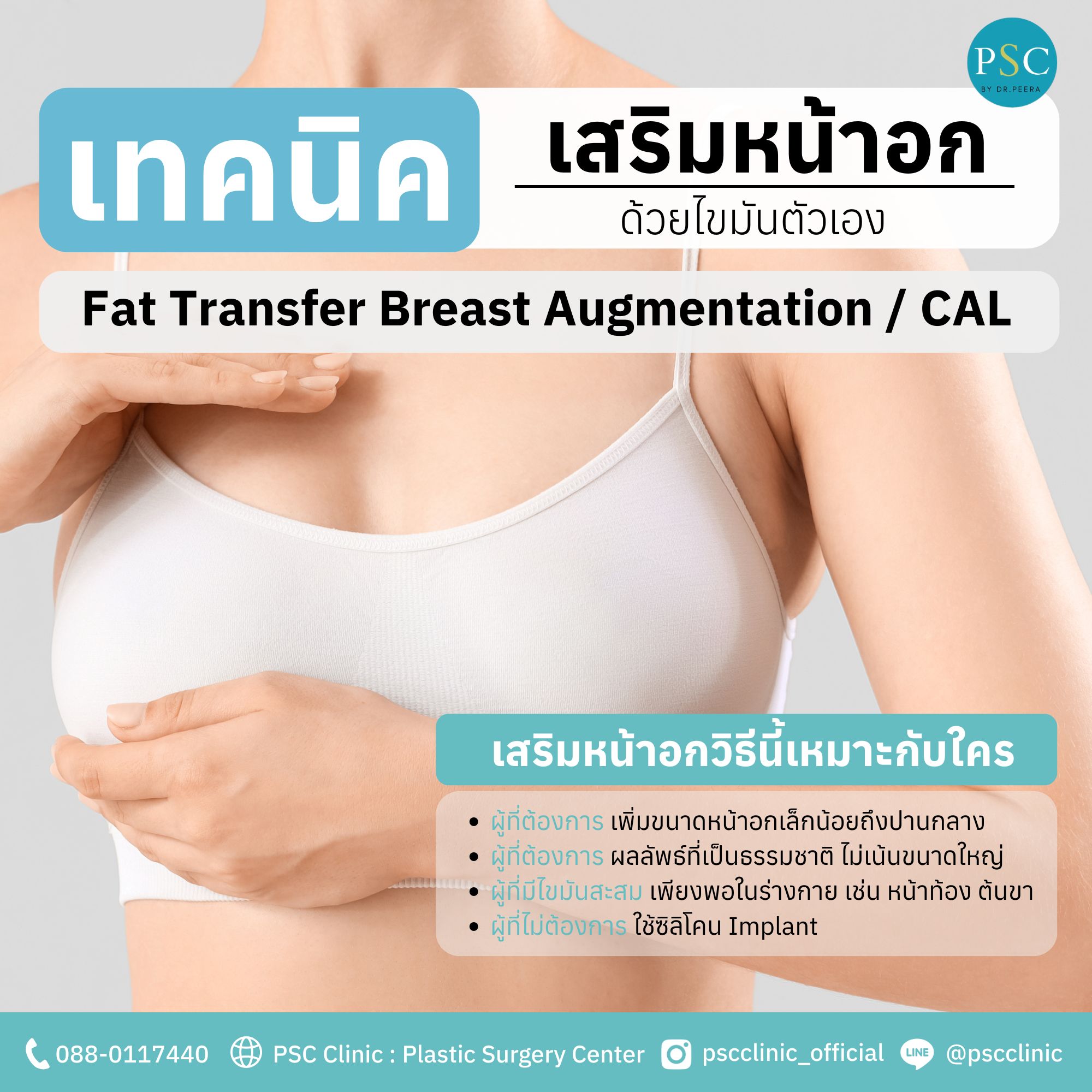 Fat Transfer Breast Augmentation / CAL