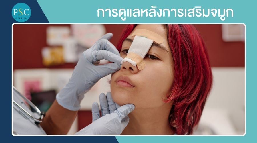 การดูแลหลังการเสริมจมูก