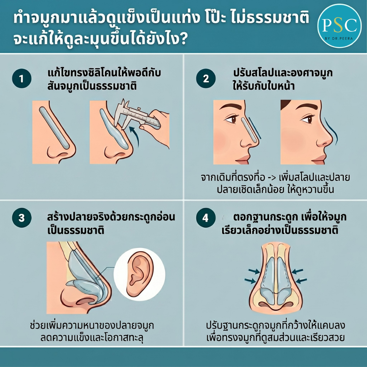 ทำจมูกมาแล้วดูแข็งเป็นแท่ง โป๊ะ ไม่ธรรมชาติ จะแก้ให้ดูละมุนขึ้นได้ยังไง?