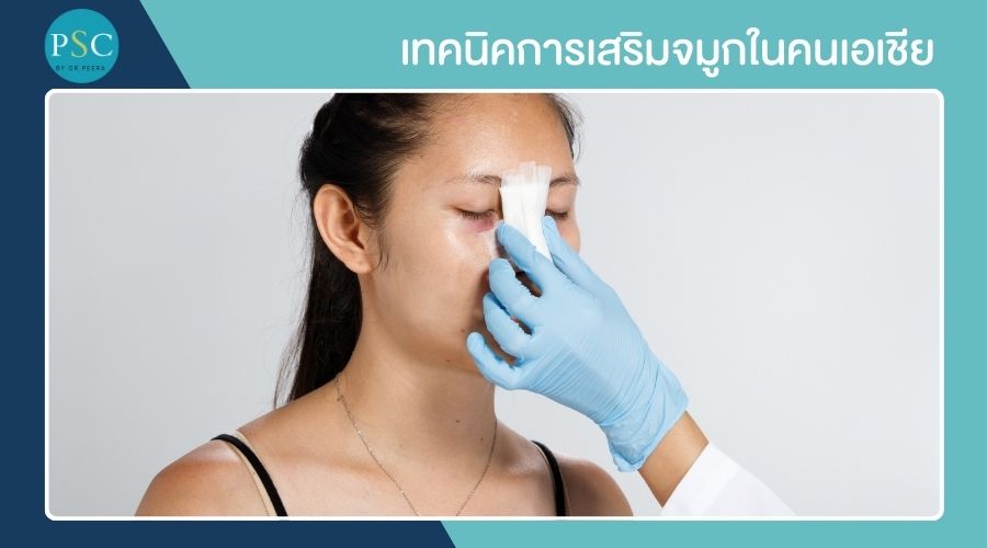 เทคนิคการเสริมจมูกในคนเอเชีย