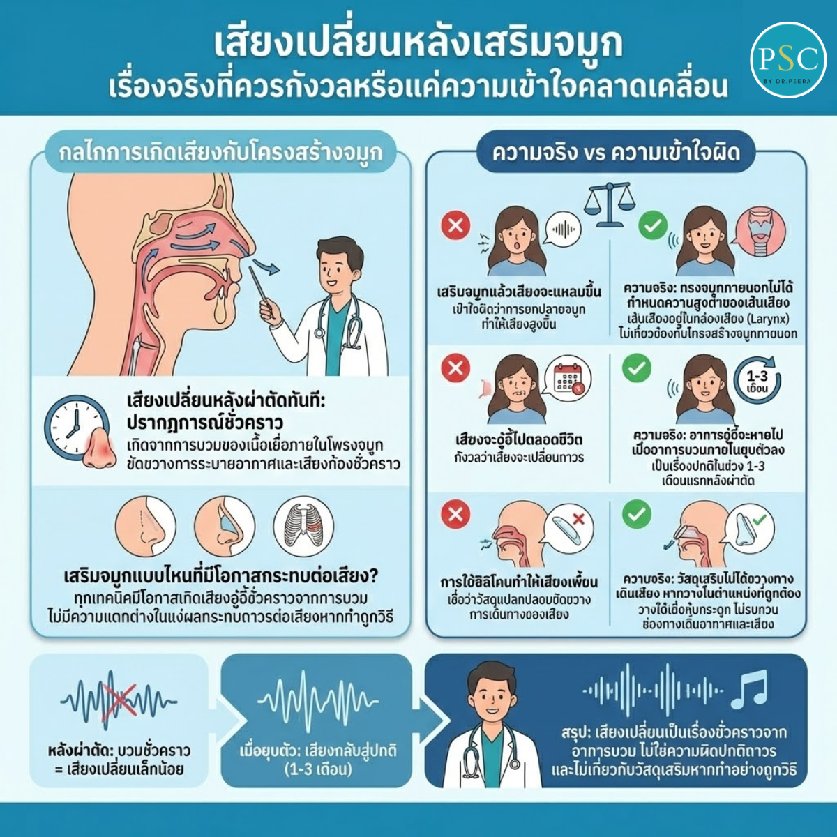 เสียงเปลี่ยนหลังเสริมจมูก เรื่องจริงที่ควรกังวลหรือแค่ความเข้าใจคลาดเคลื่อน