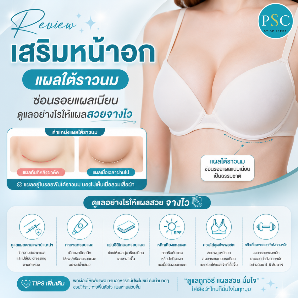 รีวิวเสริมหน้าอกแผลใต้ราวนม ซ่อนรอยแผลเนียน ดูแลอย่างไรให้แผลสวยจางไว