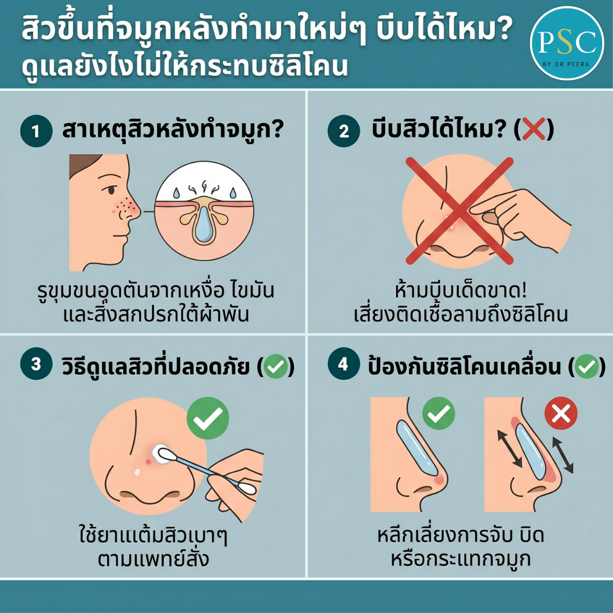 สิวขึ้นที่จมูกหลังทำมาใหม่ๆ บีบได้ไหม? ดูแลยังไงไม่ให้กระทบซิลิโคน