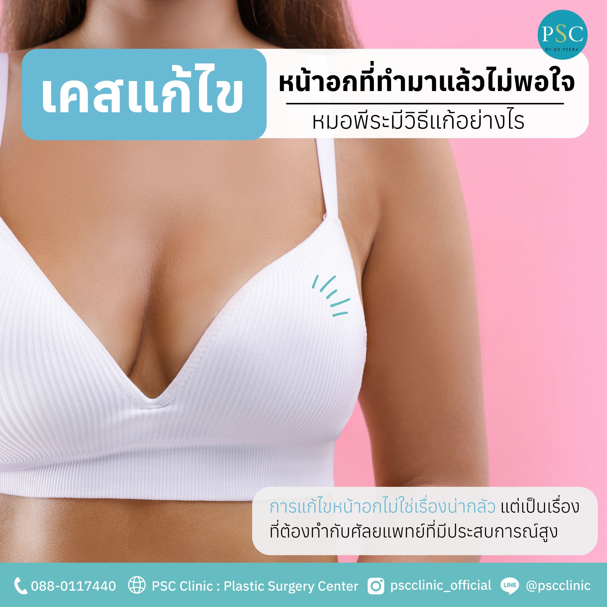 เคสแก้ไขหน้าอกที่ทำมาแล้วไม่พอใจ หมอพีระมีวิธีแก้อย่างไร