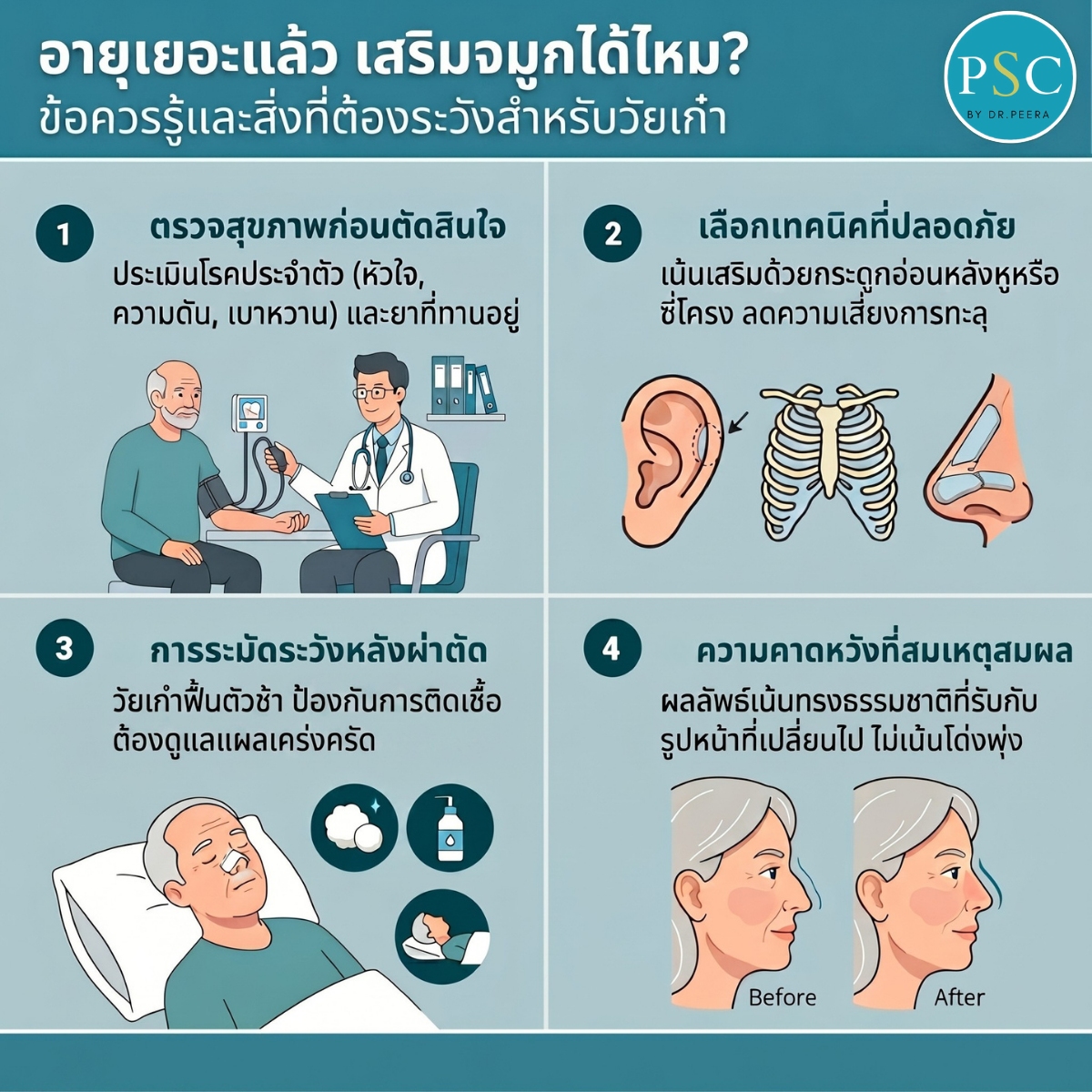 อายุเยอะแล้ว เสริมจมูกได้ไหม? ข้อควรรู้และสิ่งที่ต้องระวังสำหรับวัยเก๋า