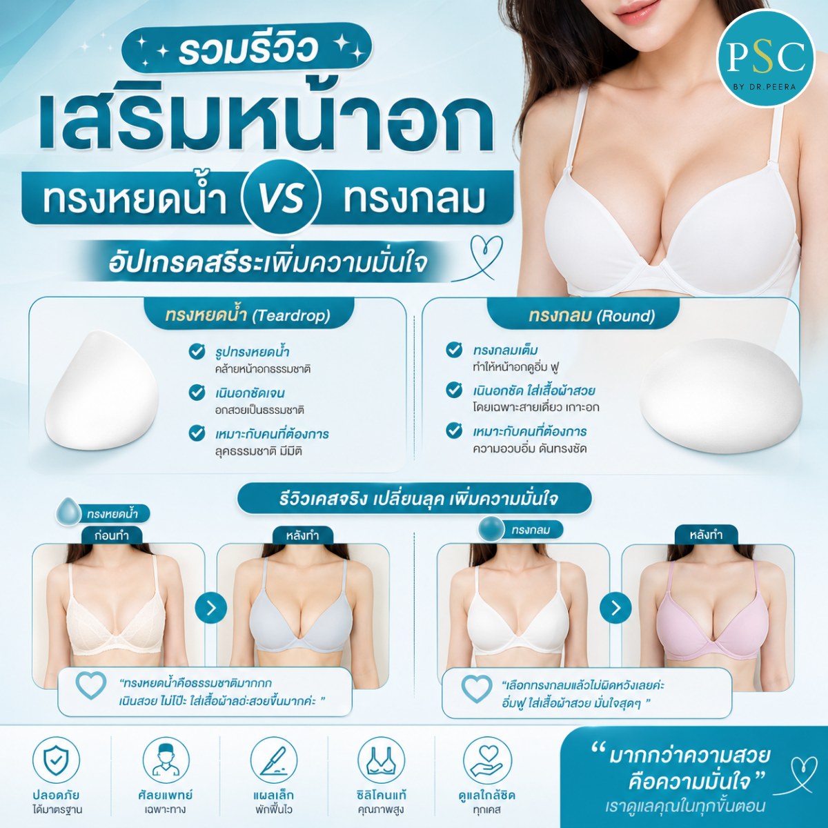 รวมรีวิวเสริมหน้าอกทรงหยดน้ำ vs ทรงกลม อัปเกรดสรีระเพิ่มความมั่นใจ