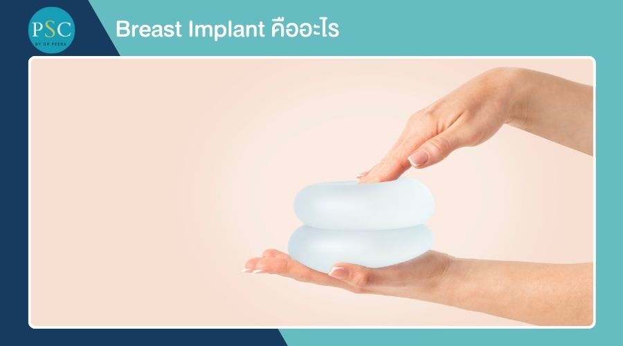 Breast Implant คืออะไร
