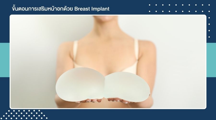 ขั้นตอนการเสริมหน้าอกด้วย Breast Implant