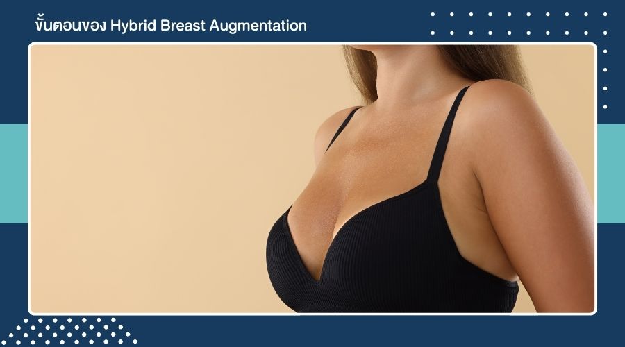 ขั้นตอนของ Hybrid Breast Augmentation