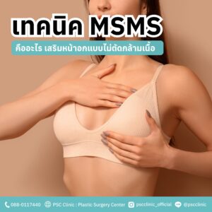 ความแตกต่างระหว่างซิลิโคนหน้าอกทรงกลม และทรงหยดน้ำ เหมาะกับใคร