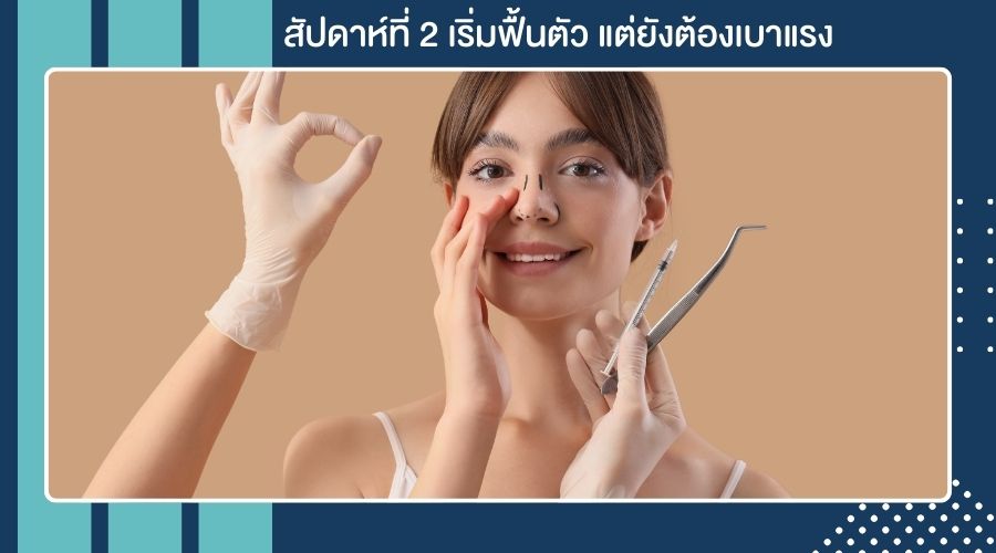 สัปดาห์ที่ 2 เริ่มฟื้นตัว แต่ยังต้องเบาแรง