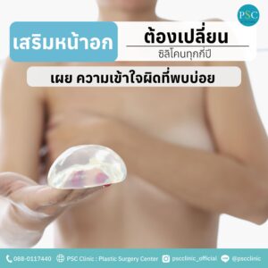 เสริมหน้าอกแล้วต้องเปลี่ยนซิลิโคนทุกกี่ปี ความเข้าใจผิดที่พบบ่อย