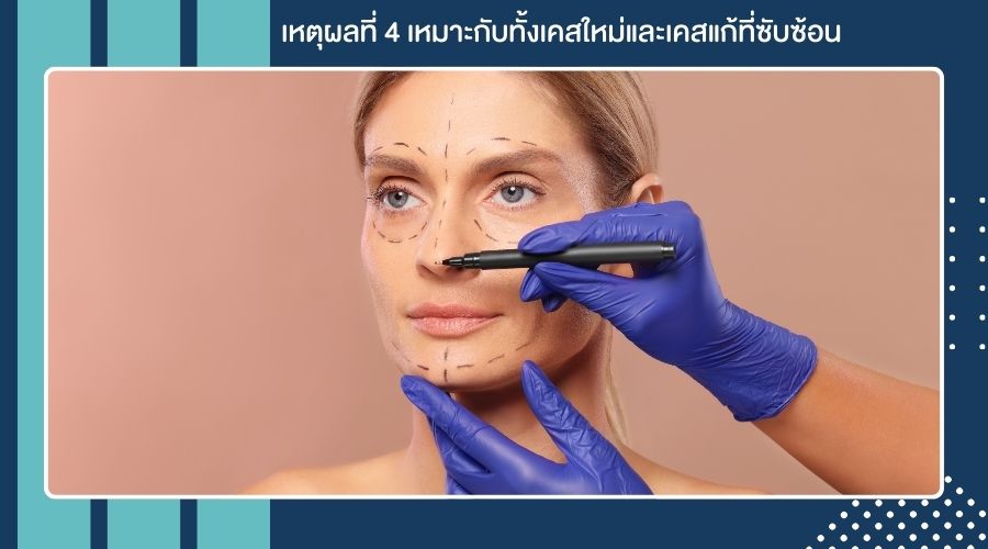 เหตุผลที่ 4 เหมาะกับทั้งเคสใหม่และเคสแก้ที่ซับซ้อน