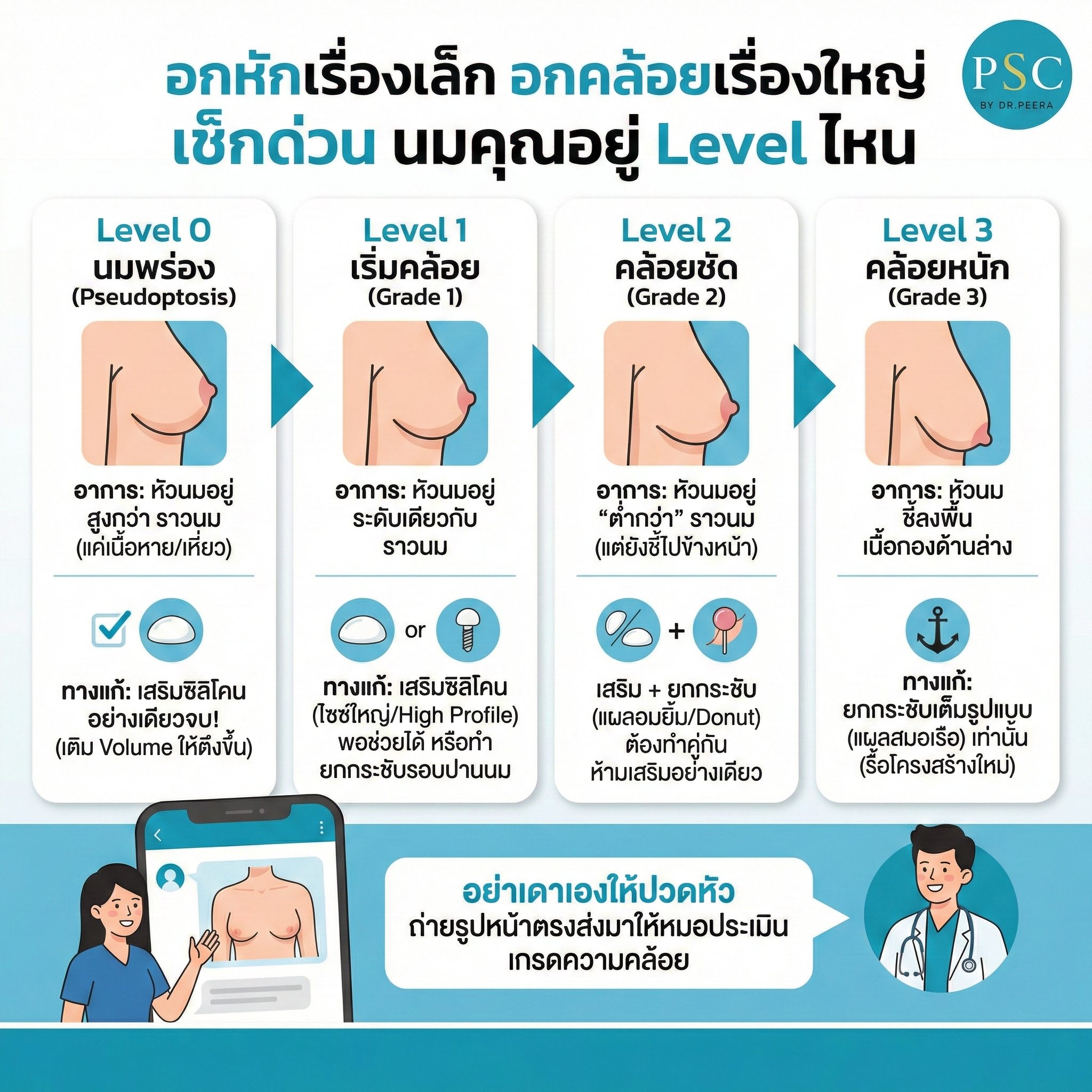 หน้าอกหย่อนคล้อย แค่เสริมซิลิโคนเอาอยู่ไหม? สอนวิธีเช็กระดับความหย่อนคล้อยด้วยตัวเองก่อนมาหาหมอ