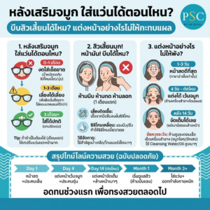 หลังเสริมจมูก ใส่แว่นได้ตอนไหน? บีบสิวเสี้ยนได้ไหม? แต่งหน้าอย่างไรไม่ให้กระทบแผล