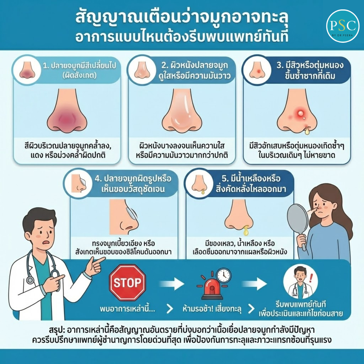 สัญญาณเตือนว่าจมูกอาจทะลุ อาการแบบไหนต้องรีบพบแพทย์ทันที