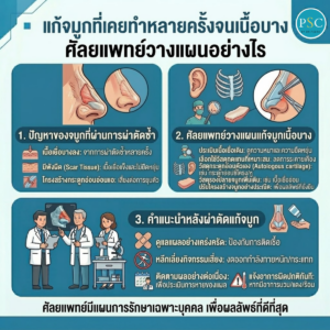 แก้จมูกที่เคยทำหลายครั้งจนเนื้อบาง ศัลยแพทย์วางแผนอย่างไร