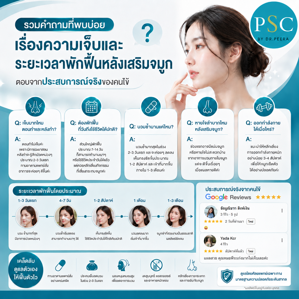 รวมคำถามที่พบบ่อยเรื่องความเจ็บและระยะเวลาพักฟื้นหลังเสริมจมูก ตอบจากประสบการณ์จริงของคนไข้